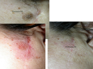 dermatologo salerno